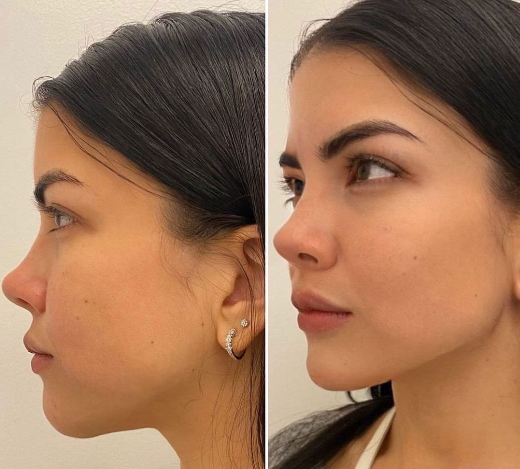 Confi-Dent Jawline Cream - Confidence Through Definition