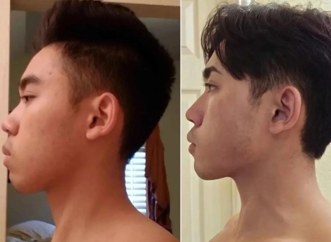 Confi-Dent Jawline Cream - Confidence Through Definition