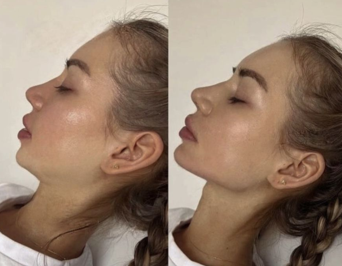 Confi-Dent Jawline Cream - Confidence Through Definition