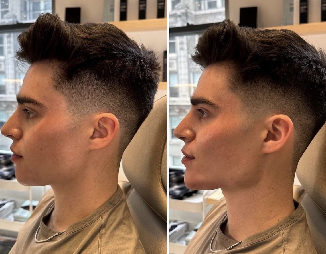 Confi-Dent Jawline Cream - Confidence Through Definition