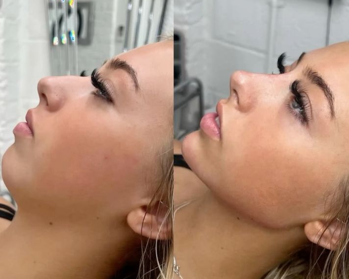 Confi-Dent Jawline Cream - Confidence Through Definition