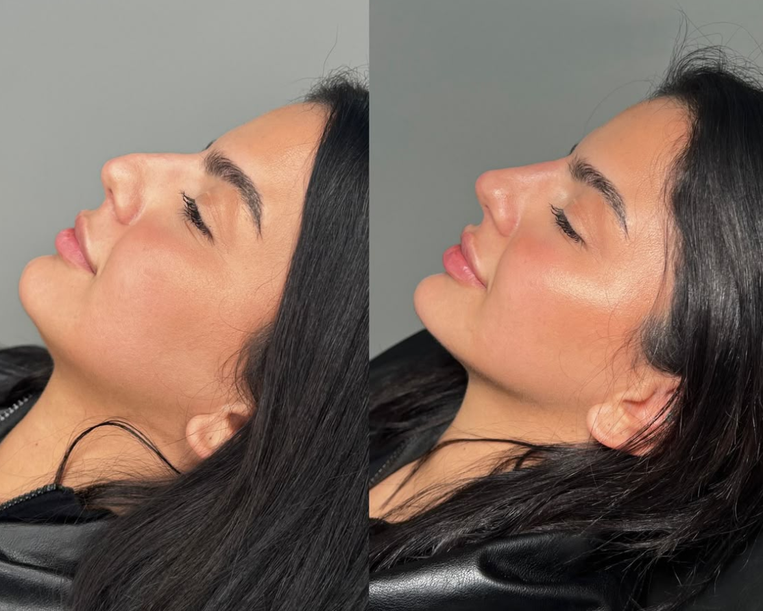 Confi-Dent Jawline Cream - Confidence Through Definition